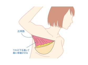 說明イラスト：わきの皮膚の下を通して胸に移動させる
